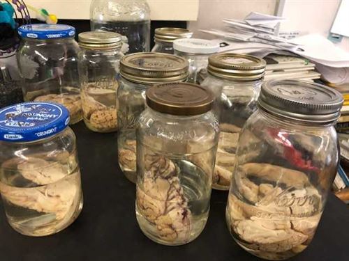 Sheep brains in jars